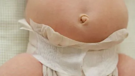 Rahitismul la sugari Simptome si fotografii de tratament (copii) Rahitismul la sugari simptome și tratament foto