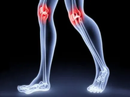 Întinzându ligamentelor genunchiului si simptomele comune tratamentul video (tratament) Întinzându ligamentelor genunchiului simptomelor comune și a fișierelor video de tratament