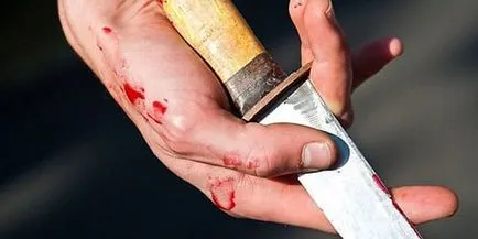 Interpretarea de vis om rănit să viseze ce un om rănit într-un vis (omul) Interpretarea de vis om rănit să viseze ce un om rănit într-un vis