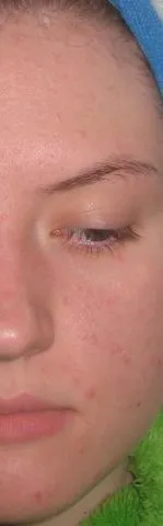 Fundația Teint miracol Lancome - comentarii, fotografii și preț
