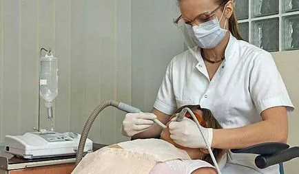 Cum de a elimina tartrul la domiciliu