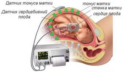 tonusul uterului în timpul sarcinii simptome, cauze si tratament (tonusul uterului în timpul sarcinii simptome) tonusul uterului în timpul sarcinii simptome, cauze si tratament