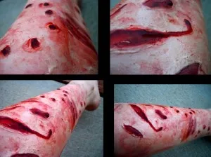 Muscata de un câine ce să facă primul ajutor (do) Muscata de un câine ce să facă primul ajutor