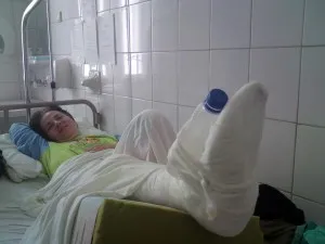 Tipuri de fracturi ale călcâiului și caracteristicile de tratament și reabilitare