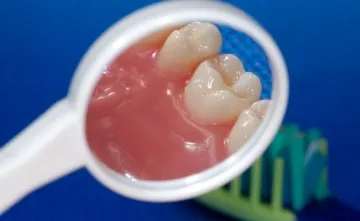 gingiile inflamate sunt dureroase și ce să facă și cum să trateze