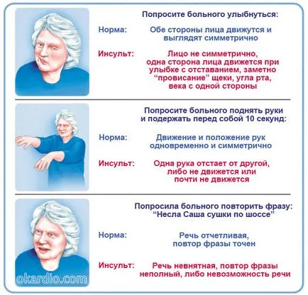 Toate simptomele unui accident vascular cerebral și primele semne ale unei analize complete (semne) Toate simptomele unui accident vascular cerebral și primele semne ale unei revizuiri complete