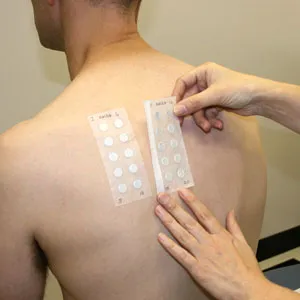Alergia la această mână care Alergia la această mână care