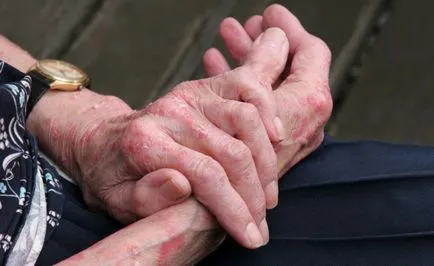 Alergia la această mână care