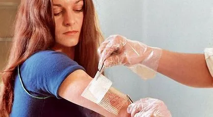 Această răspândire a arsurii Această răspândire a arsurii