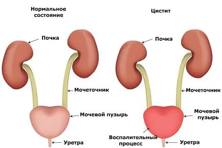 Durere la nivelul vezicii urinare, care este