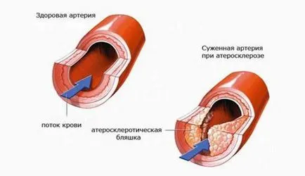usturoi si lamaie tratament usturoi si lamaie tratament