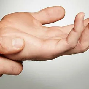 tratamentul paronychia tratamentul paronychia