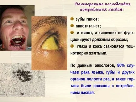 Nasvay la domiciliu