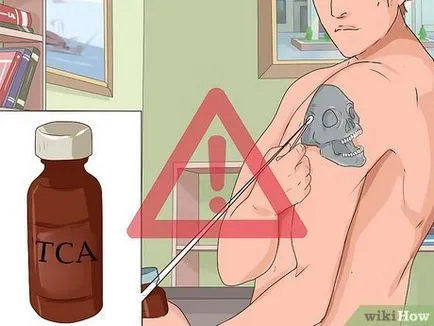 Cum și ce pentru a elimina un tatuaj