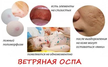Ce este infectii copilarie Ce este infectii copilarie