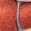 Cum de a trata ficat Cum de a trata ficat