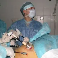 Ce este laparoscopia uterului
