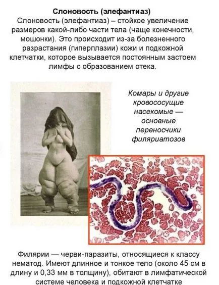 Ce este lymphostasis picioare
