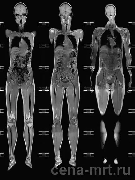 tomografia Sondaj tomografia Sondaj