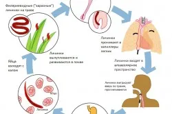 tratamentul nemozolom