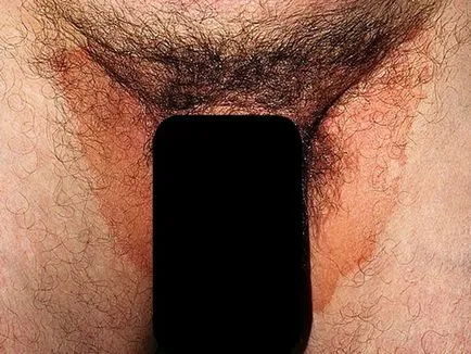 Tratamentul ciuperca în zona abdomenului