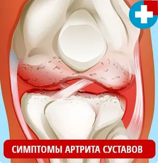 Din ce artropil Din ce artropil