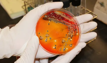 Salmoneloza decât vindecarea Salmoneloza decât vindecarea