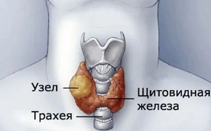 Volumul tiroidian la copii Volumul tiroidian la copii