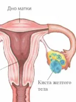 Cum de a declanșa ovulația la domiciliu Cum de a declanșa ovulația la domiciliu