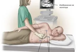 Diagnostic cu ultrasunete este