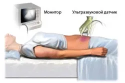 Diagnostic cu ultrasunete este