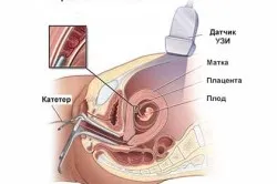 Diagnostic cu ultrasunete este