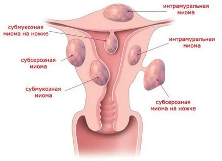 Trage abdomenul inferior ca lunar