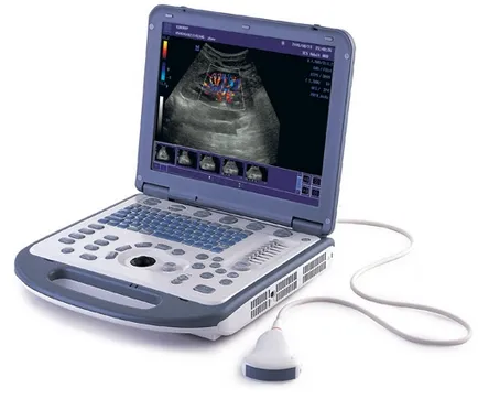 Diagnostic cu ultrasunete este Diagnostic cu ultrasunete este
