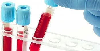Cum de a reduce imunoglobulină Cum de a reduce imunoglobulină