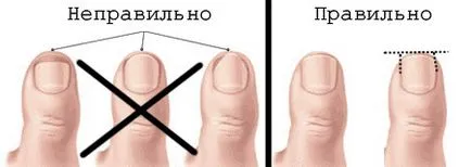 Pentru a trata o unghie incarnata acasă