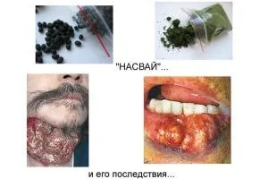 Nasvay la domiciliu
