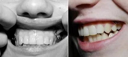 10 cele mai extreme piercing orale și modificări ale corpului (piercing) 10 cele mai extreme piercing orale și modificări ale corpului