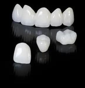 5 puncte pentru ce ar trebui să alegeți din coroane integral ceramice!