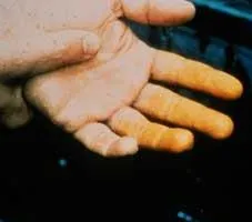 Proprietățile de acid azotic, preparare și utilizare