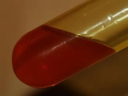 Proprietățile de acid azotic, preparare și utilizare