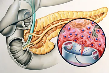 Durere in pancreas decat elimina durerea, cauzele sindromului (elimina) Durere in pancreas decat elimina durerea, cauzele sindromului