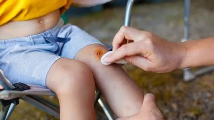 Medicamentul și căile de atac populare procesului de abraziune