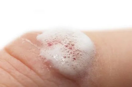 Ce este în valoare de a cumpăra de la farmacie, chiar dacă este sănătos (drogherie) Ce este în valoare de a cumpăra de la farmacie, chiar dacă sănătos