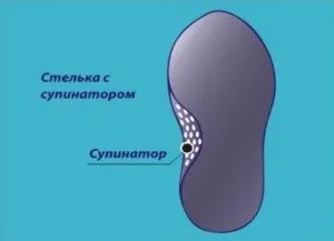 Ce este căpută în tipurile de pantofi de tălpi ortopedice (specii) Ce este scobitura în tipurile de pantofi de tălpi interioare ortopedice