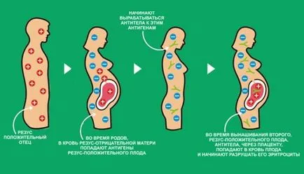 Paralizie cerebrală - cauze, simptome si tratament (care rezultă din cauza prejudiciului) paralizie cerebrala - cauze, simptome și tratament