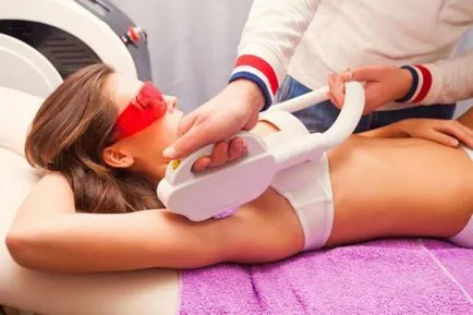 Ceruire & indepartarea parului
