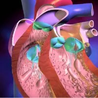 Diagnosticul de boli cardiovasculare - un bisturiu - informații medicale și educație (boli) Diagnosticul de boli cardiovasculare - un bisturiu - informații medicale și educație
