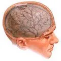 tratament creier hidrocefalie, simptome si cauze (tratament) creier hidrocefalie tratament, simptome si cauze