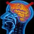 creier tratament hidrocefalie, simptome si cauze (simptome) creier hidrocefalie tratament, simptome si cauze
